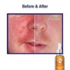 Pro-Heal Serum Advance+ antioxidant-rich serum containing vitamin C, E, and A for redness, rosacea, inflammation