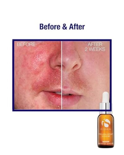 Pro-Heal Serum Advance+ antioxidant-rich serum containing vitamin C, E, and A for redness, rosacea, inflammation