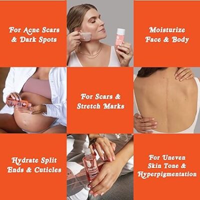 Bio-Oil Skincare Body Oil, Vitamin E, Serum for Scars & Stretchmarks, Face & Body Moisturizer, 2 oz, All Skin Types
